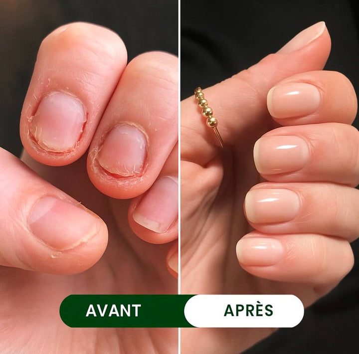 Bagues rotatives contre le stress( 1 acheté , 2 offerts )